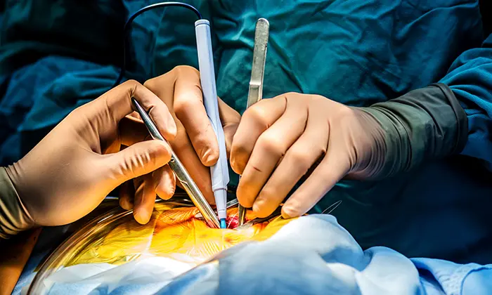 Avances en medicina cardiovascular